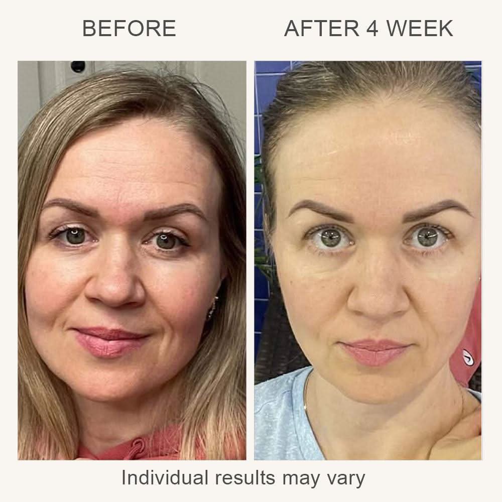 VIA 3-in-1 Skin Rejuvenation Device