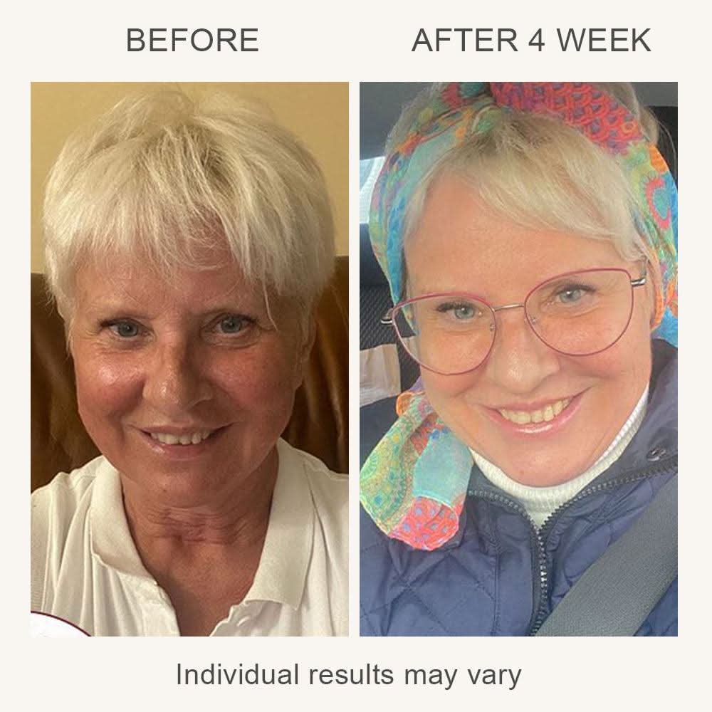 VIA 3-in-1 Skin Rejuvenation Device