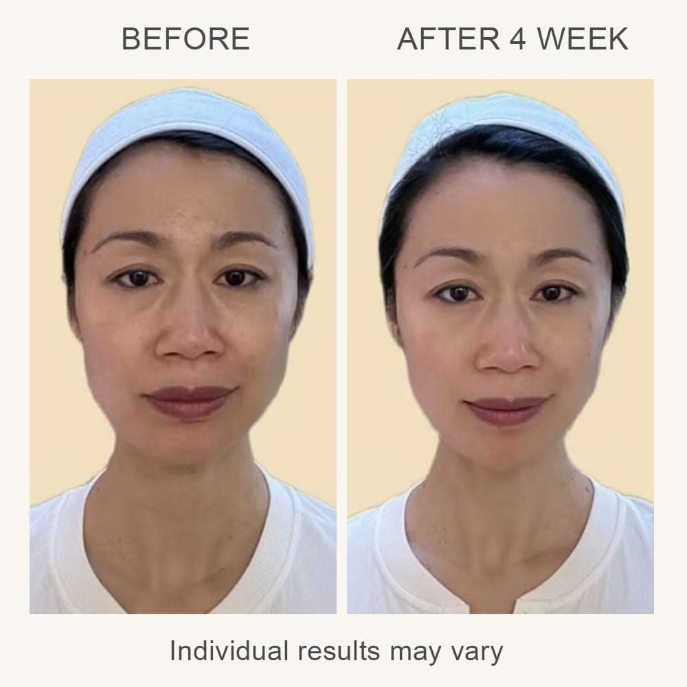 VIA 3-in-1 Skin Rejuvenation Device