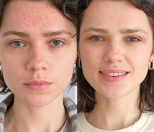 Customer Review Image