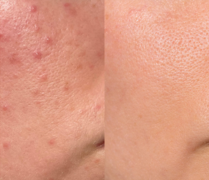 Customer Review Image