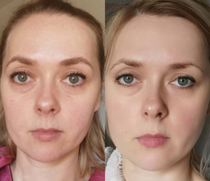 Customer Review Image