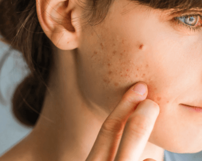 Common Skincare Concerns And Their Solutions