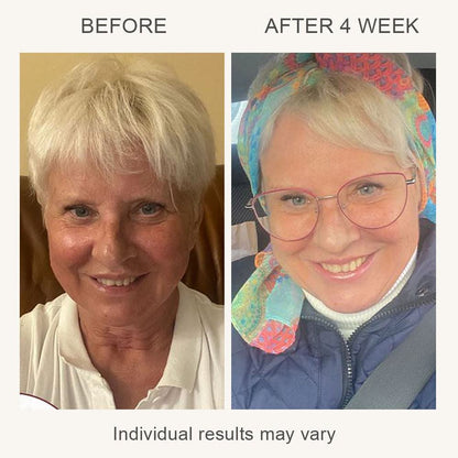 VIA 3-in-1 Skin Rejuvenation Device
